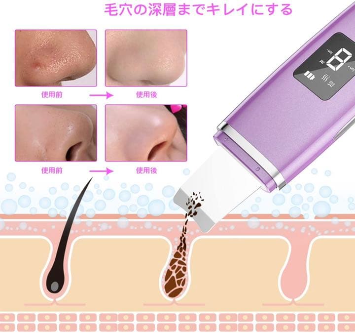 ウォーターピーリング 超音波美顔器 ピーリング 美顔器IPX5防水 50000回