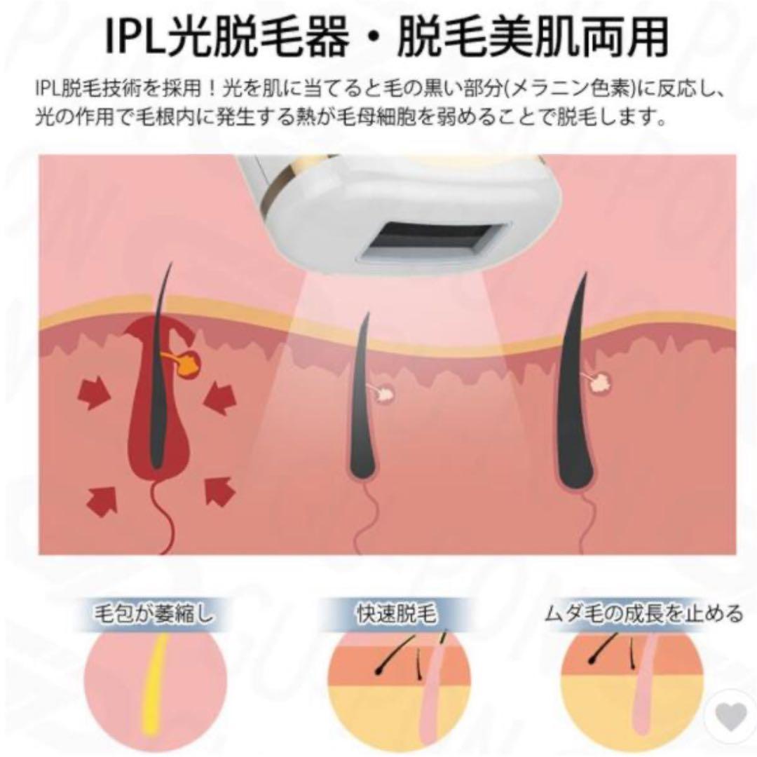 脱毛器《新品！》