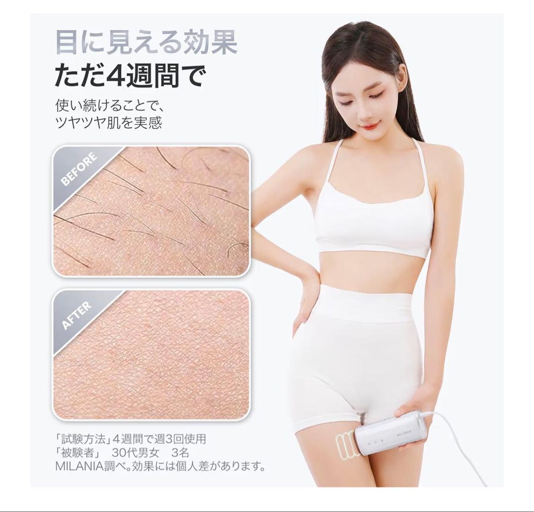 MILANIA M1 脱毛器 VIO対応 光美容器 全身ムダ毛ケア PSE認証済