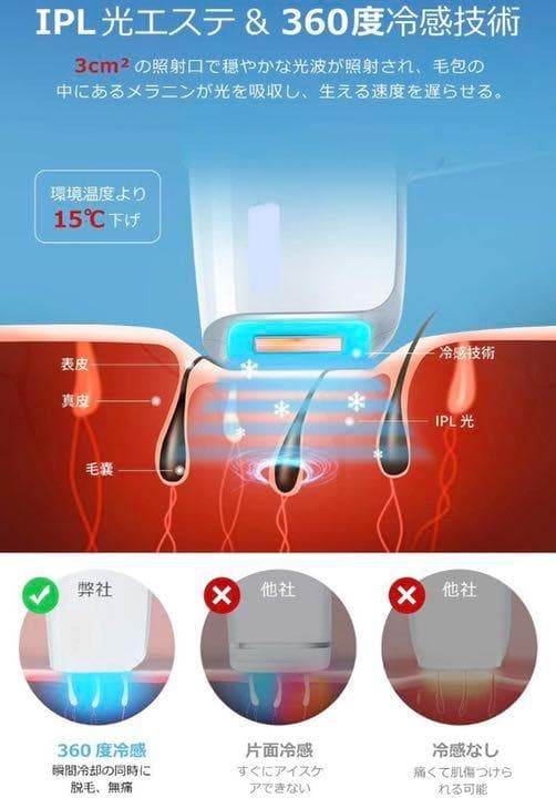 ❤最新WPL機能搭載❣自宅で脱毛サロン級の安心安全な脱毛♪❤氷感IPL光脱毛器