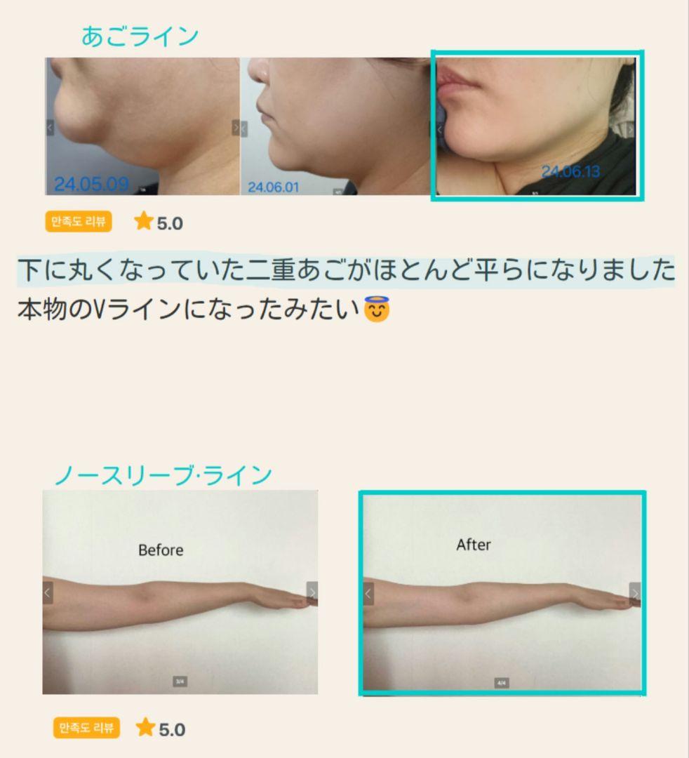 KSKINNY PCL Body Ampoule　ケイスキニー