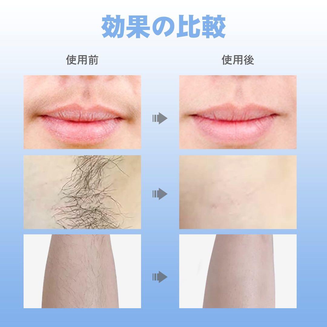 脱毛器 IPL脱毛器 レーザー脱毛器 vio対応 家庭用脱毛器 冷感 痛みのない
