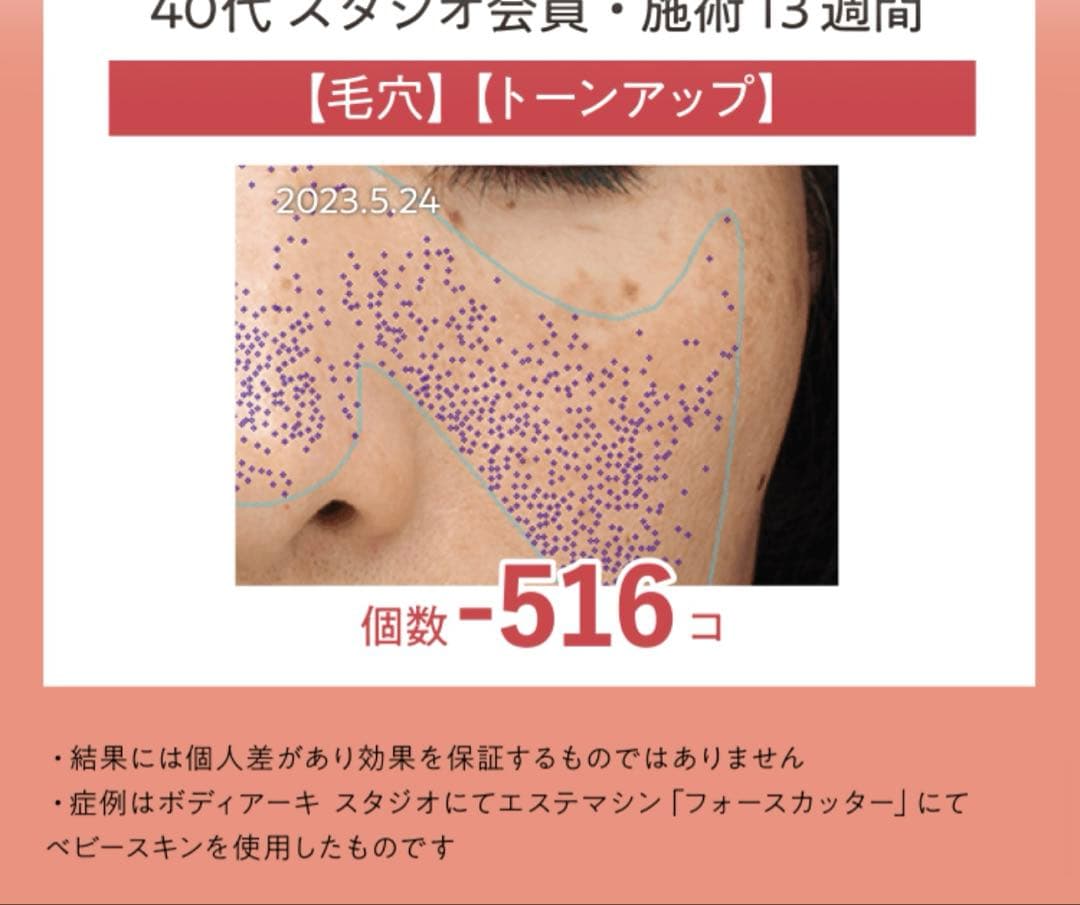 T*7様 美顔器クリニック級幹細胞湘南美容外科全面監督医療レベル美顔器ベビースキ