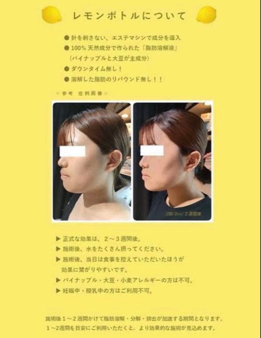 AMBE　レモンボトル3本