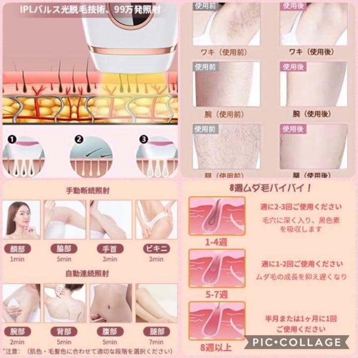 ❤99万回照射❣プロのIPL光エステ技術で100％安全安心♪❤IPL光脱毛器