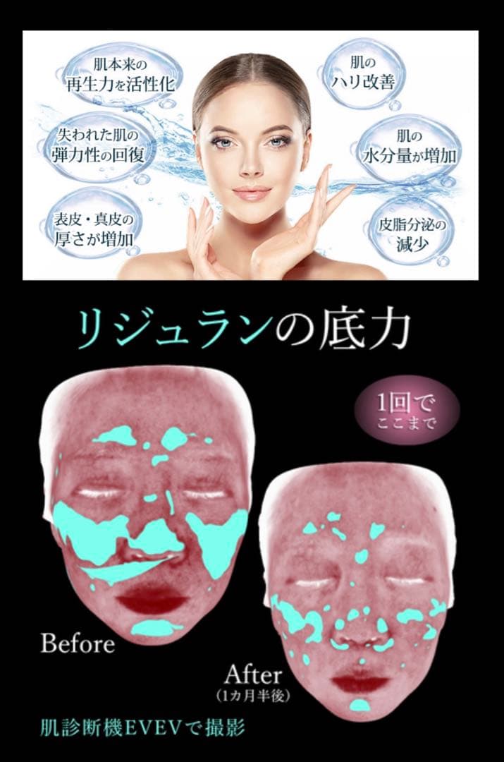 美容オタクのハナネェ　オーキッドグロー、高純度リジュラン
