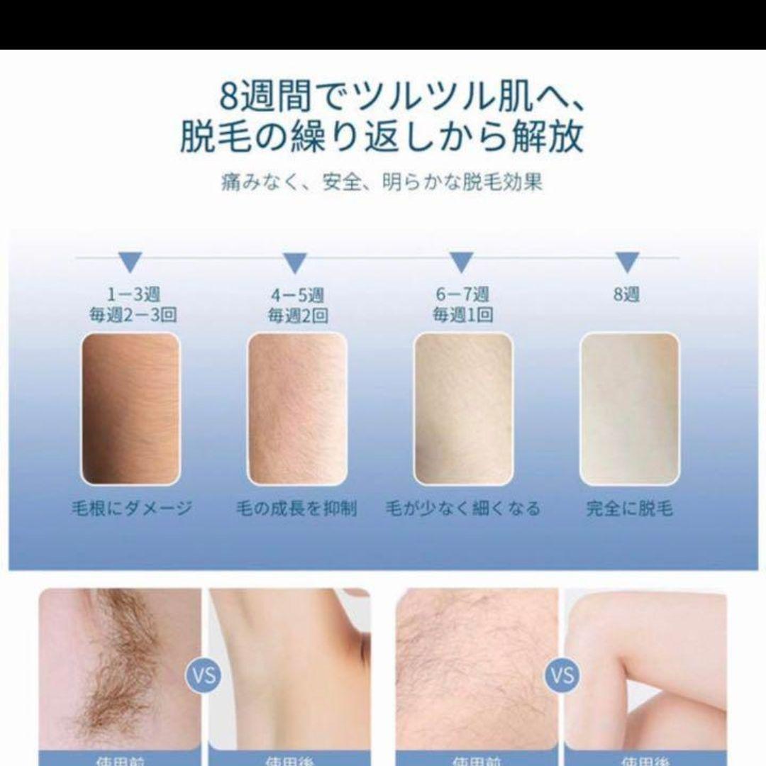 脱毛器 光脱毛 無痛 全身用 フラッシュ レーザー  脱毛　VIO