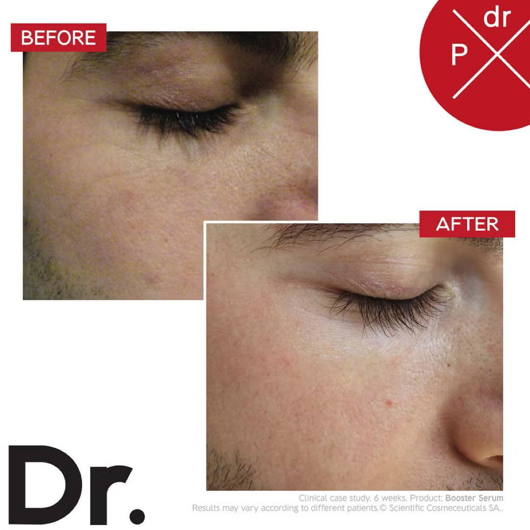 Dr. LEVY INTENSE Booster Serum 美容液