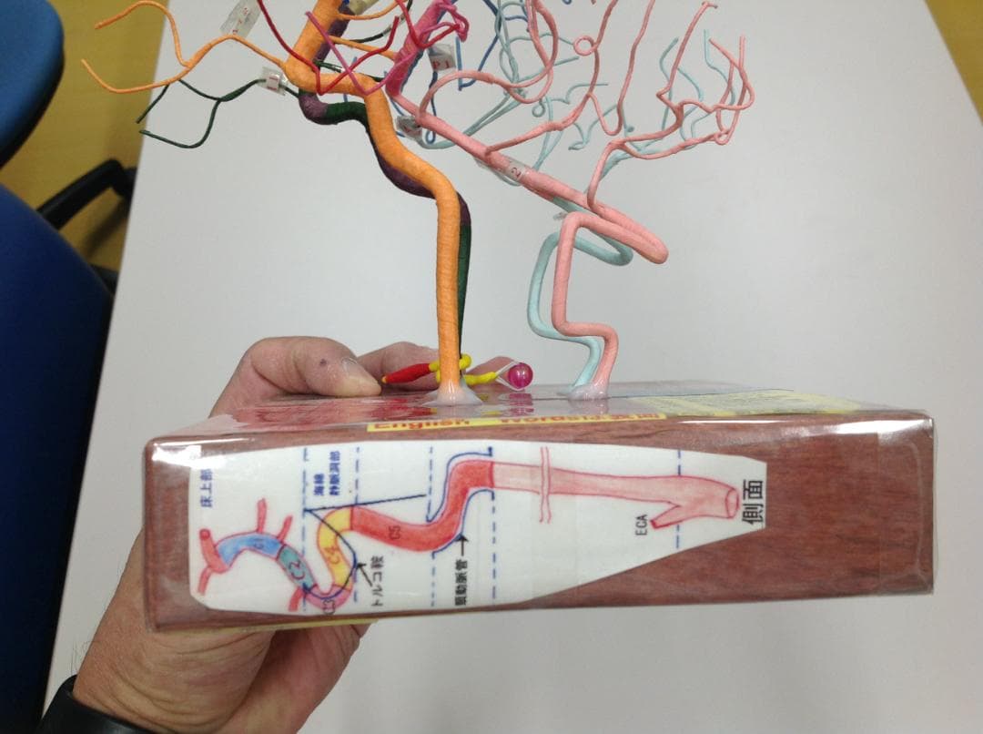 脳血管模型（脳血管模型を作れない必要な人のために） 脳血管模型KAGAWAモデル