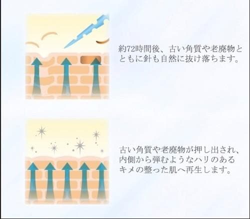 針美容液 スピキュールゲル[SPIQRIE] 30g 美容液 サロン専売商品