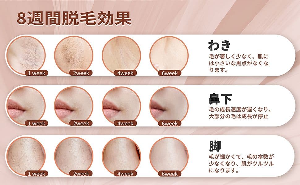 脱毛器 99万回以上フラッシュ 5段階設定 アタッチメント付き 全身脱毛 家庭用