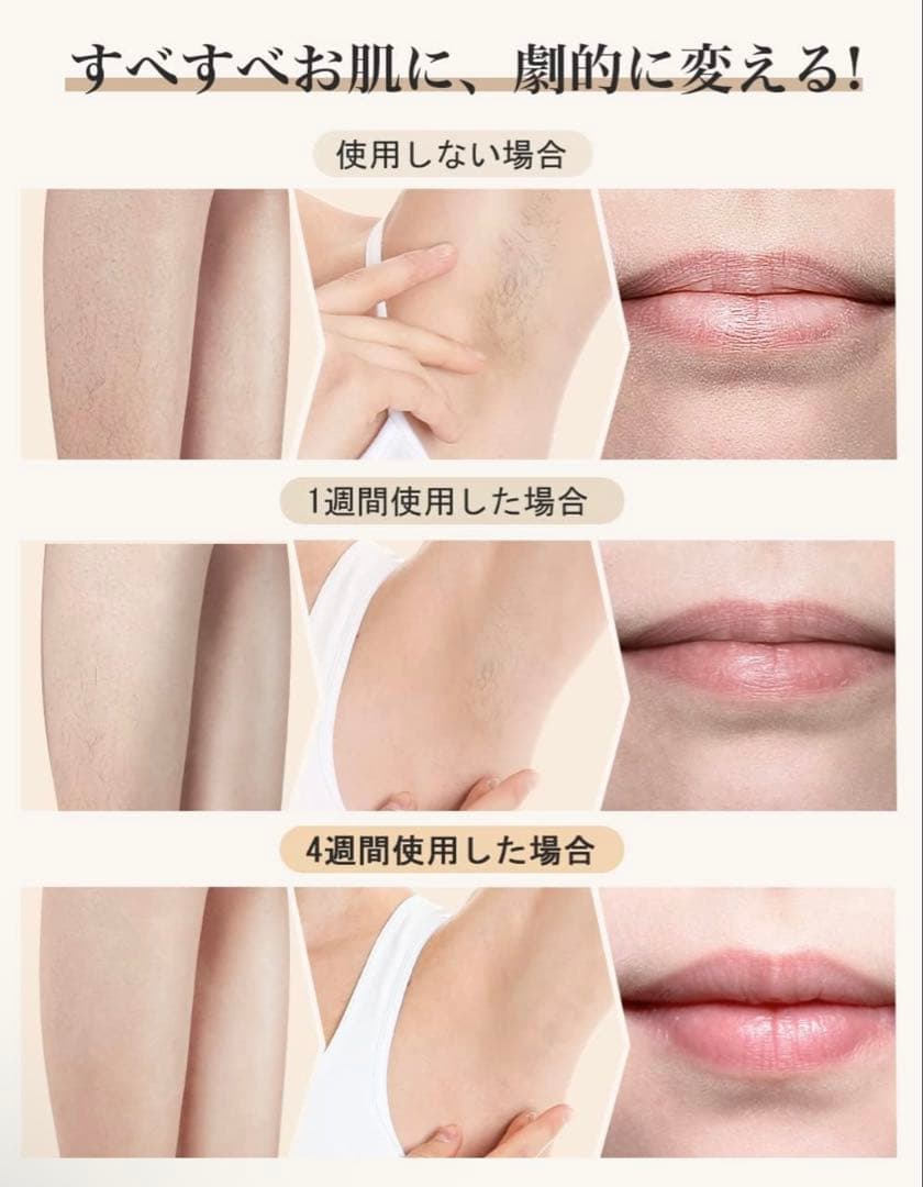BIZINN 脱毛器 冷感無痛脱毛【サファイア冷感 無制限回照射】 家庭用脱毛器
